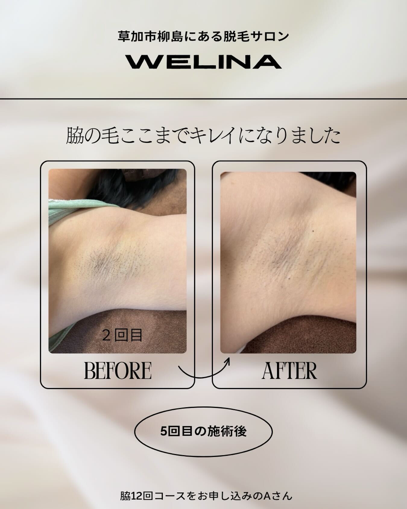 4月でこの暑さまいりますね💦